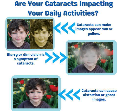 are your cataracts impacting your daily activites?