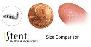 Size of an iStent implant compared to a penny and a human fingertip.